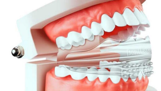 Переваги купівлі стоматологічних відбілюючих систем та матеріалів в Інтернеті